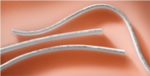 FlowLine Bipore Heparin ePTFE Vascular Graft from JOTEC