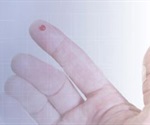 Point of Care Testing for Diabetes Management