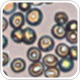 Using Ultraviolet Microscopy and Microspectroscopy for Analysis of Red Blood Cells
