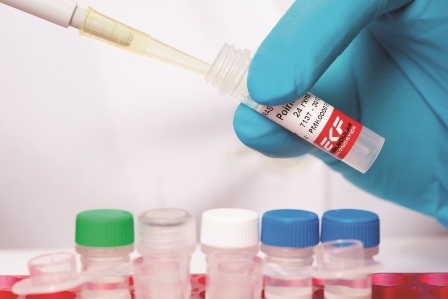 EKF Diagnostics test