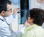 Deep learning method enhances vessel and plaque segmentation in stroke diagnosis