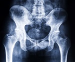 Generative AI system from Northwestern doubles radiology efficiency