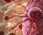 New link found between cellular stress and aggressive pancreatic cancer