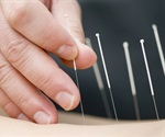 Pain clinics made millions from ‘unnecessary’ injections into ‘human pin cushions’