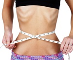 Eating too much in childhood predicts development of bulimia nervosa in adulthood