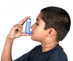 Inflammatory cells may persist despite biologic therapy in severe asthma
