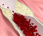 3D nanomatrix vascular sheet model for high-throughput atherosclerosis drug testing