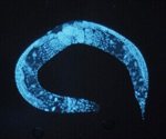What is MicroRNA?