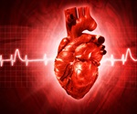 Stenting improves long term outcomes in CTO PCI patients