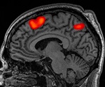 Brain imaging analyses can reveal wounds of childhood trauma