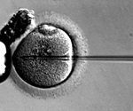 Genetically engineered skin grafts help heal chronic wounds in patients with epidermolysis bullosa