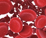 Targeting the hemoglobin problem in sickle cell disease using a new drug