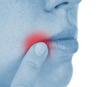 Herpes virus reshapes the human genome's architecture to aid its replication