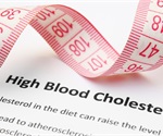 What are Lipoproteins?