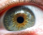 New research may help treatment of Norrie disease and familial exudative vitreoretinopathy (FEVR)