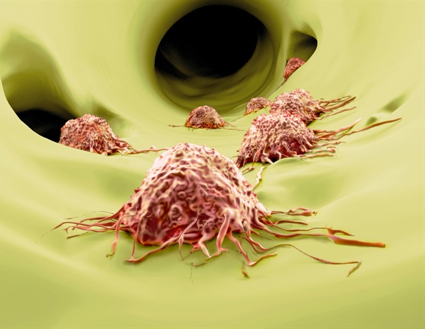 Key protein found to guide melanoma cells during spread