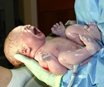 Early antibiotic exposure weakens infant immune development