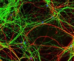 New research examines how alcohol exposure impacts aspects of neuroplasticity