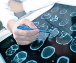 Spear Bio launches next generation ultrasensitive immunoassay solution SPEAR UltraDetect™ to transform neurodegenerative disease research