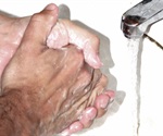 Obsessive compulsive disorder (OCD)