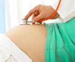 Premature ovarian insufficiency in women linked to greater risk of severe autoimmune conditions