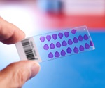 AI-powered model improves prediction of bladder cancer treatment outcomes