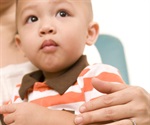 Anti-reflux surgery - research may lead to changes in treatment recommendations