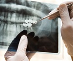 More UK health professionals will be able to prescribe medicines