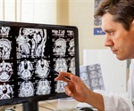 Global experts release guidance on CT imaging for post-COVID lung abnormalities