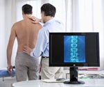 Early clinical events predict disease progression in very early systemic sclerosis