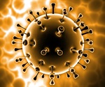 Macrophage-derived lipocalin 2 drives severe pneumonia in SARS-CoV-2 infection