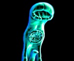 Researchers find immune system proteins involved in severe cases of schistosomiasis