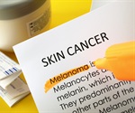 AI-powered dual-imaging approach enhances skin cancer detection accuracy