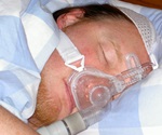 Rising temperatures linked to more severe sleep apnea worldwide