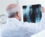 Minimally invasive spine surgery