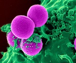 Could a rare, deadly ‘superbug’ fungus be gaining a foothold?
