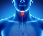 Thyroid disorders are often misdiagnosed