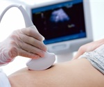 What is an Echogenic Intracardiac Focus?