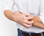 Study shows limited benefits of elimination diets for children with atopic dermatitis
