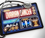 Breakthrough therapy targets aggressive bladder cancer variant