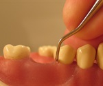 Polymer patch senses dangerous leaks on sutures