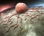 Senescent macrophages emerge as key drivers of tumor progression