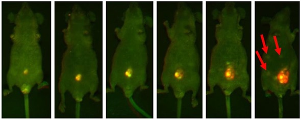 Representative mouse highlighting the progressive increasing luminosity of an implanted lesion in the peritoneum. Each image was captured using both GFP and RFP filters and then multiplexed. The intense fluorescent signal shown in the implanted tumor is significantly brighter than the surrounding tissue. Note the formation of metastatic lesions beginning to develop distal to the site of implantation and becoming visible within the abdomen in the final slide (red arrows).