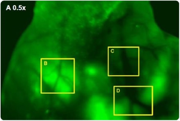 (A) GFP-Fluorescent signals were imaged with iBox Explorer at 0.5x magnification corresponds to a field of view of 30mm2 window. Areas with angiogenic vessels around tumor were marked. Figs. 3 (B, C, D) correspondent areas with angiogenic vessels were imaged at 1.66x or 2.50x magnifications, which correspond to fields of view of 9mm2 or 6mm2 respectively. Angiogenic vessels were marked with yellow dashes.