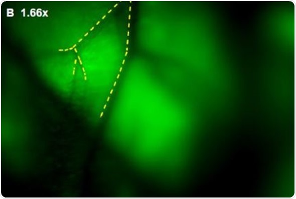 (A) GFP-Fluorescent signals were imaged with iBox Explorer at 0.5x magnification corresponds to a field of view of 30mm2 window. Areas with angiogenic vessels around tumor were marked. Figs. 3 (B, C, D) correspondent areas with angiogenic vessels were imaged at 1.66x or 2.50x magnifications, which correspond to fields of view of 9mm2 or 6mm2 respectively. Angiogenic vessels were marked with yellow dashes.