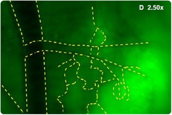 (A) GFP-Fluorescent signals were imaged with iBox Explorer at 0.5x magnification corresponds to a field of view of 30mm2 window. Areas with angiogenic vessels around tumor were marked. Figs. 3 (B, C, D) correspondent areas with angiogenic vessels were imaged at 1.66x or 2.50x magnifications, which correspond to fields of view of 9mm2 or 6mm2 respectively. Angiogenic vessels were marked with yellow dashes.