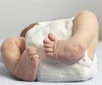 What Causes Clubbing of the Fingers or Toes?