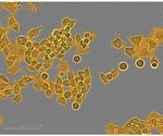 Quantitative Measurement of Cancer Cell Proliferation Using CellPlayer™ Kinetic Proliferation Assay
