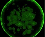 Simplifying iPSC Work Flow with IncuCyte Live Content Imaging System
