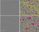 Validation of NeuroTrack Assay for Medium-Throughput Testing in 96-Well Format